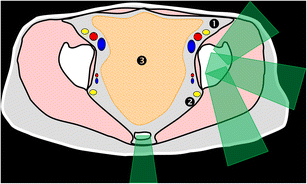 Fig. 10