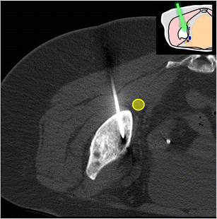 Fig. 12