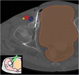 Fig. 15