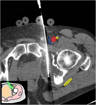 Fig. 22