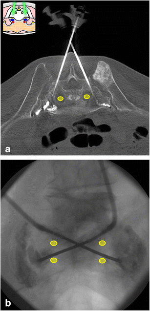 Fig. 23