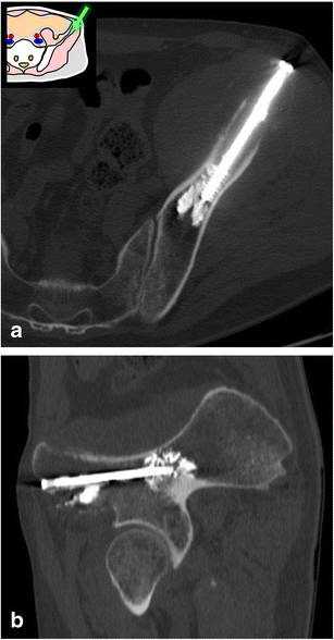 Fig. 24