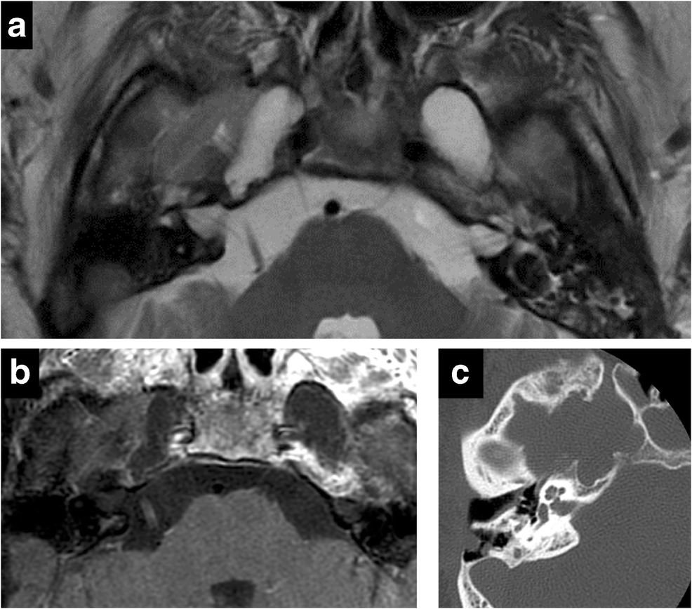 Fig. 10