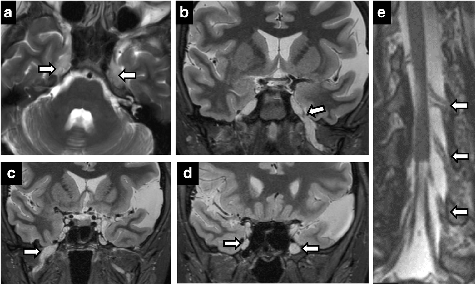 Fig. 13