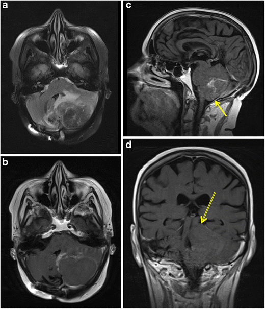 Fig. 11