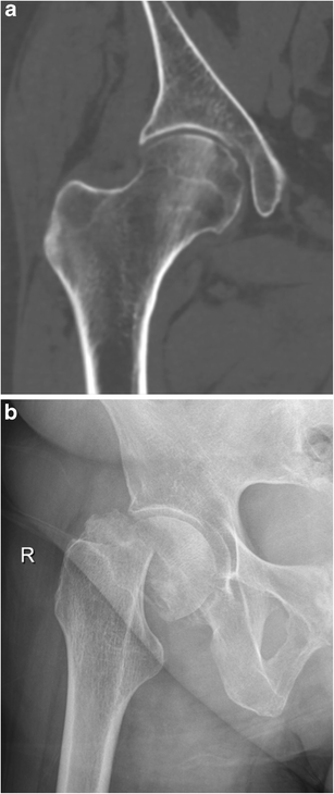 Fig. 12