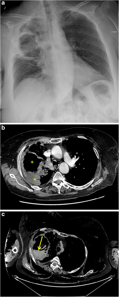 Fig. 5