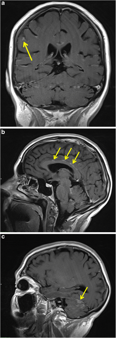 Fig. 9