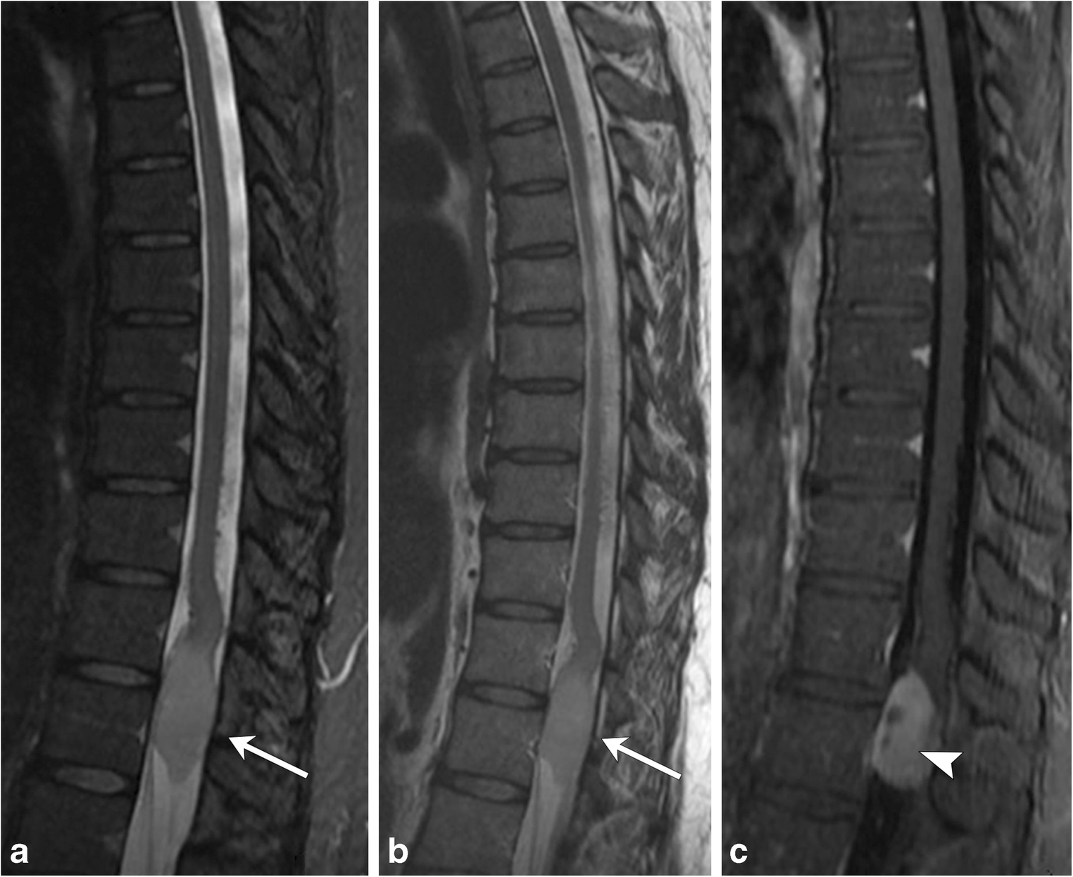 Fig. 17