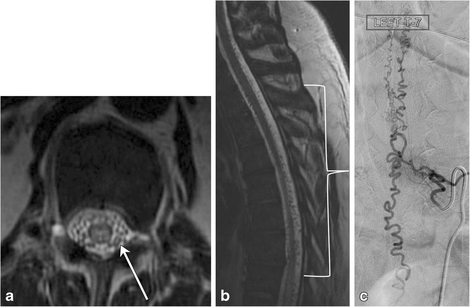 Fig. 18