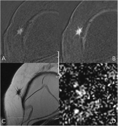 Fig. 11