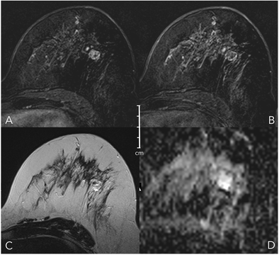 Fig. 13