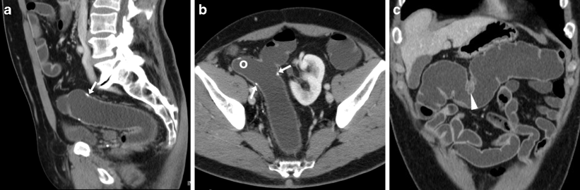 Fig. 13