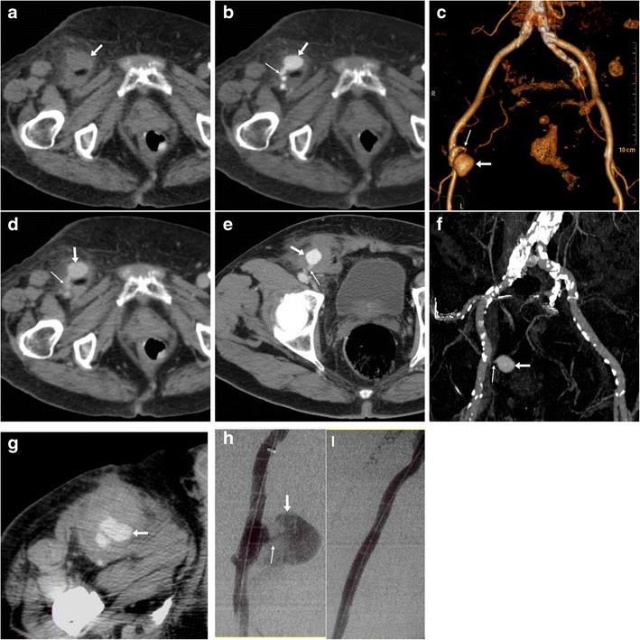 Fig. 5