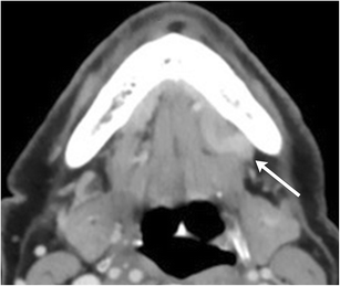 Fig. 18