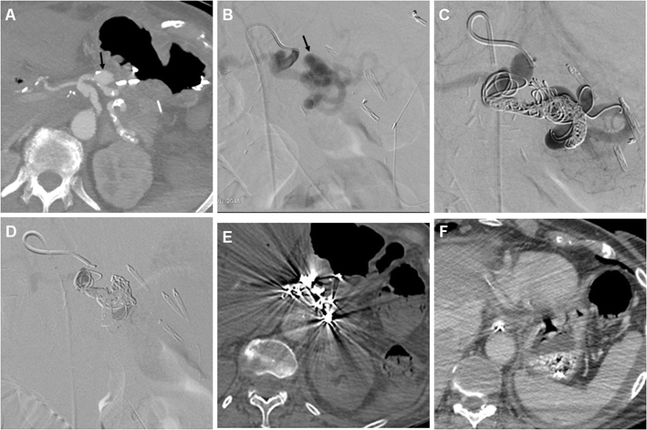 Fig. 13