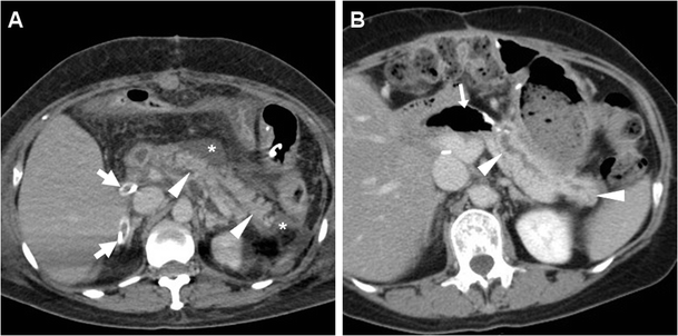 Fig. 14