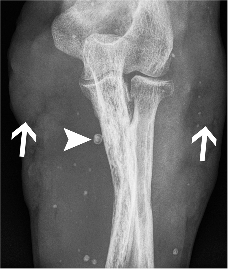 Fig. 22