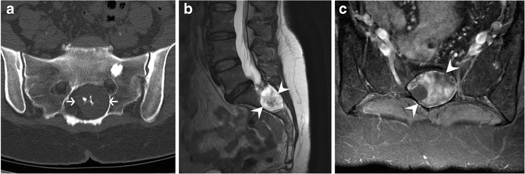 Fig. 24