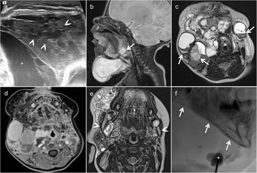 Fig. 12