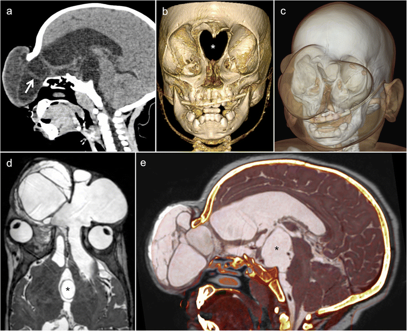 Fig. 13