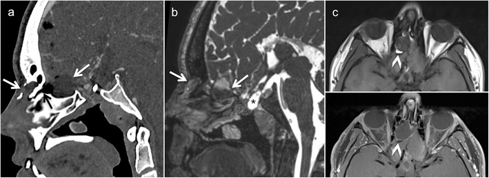 Fig. 9