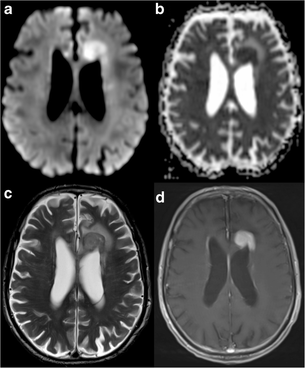 Fig. 5