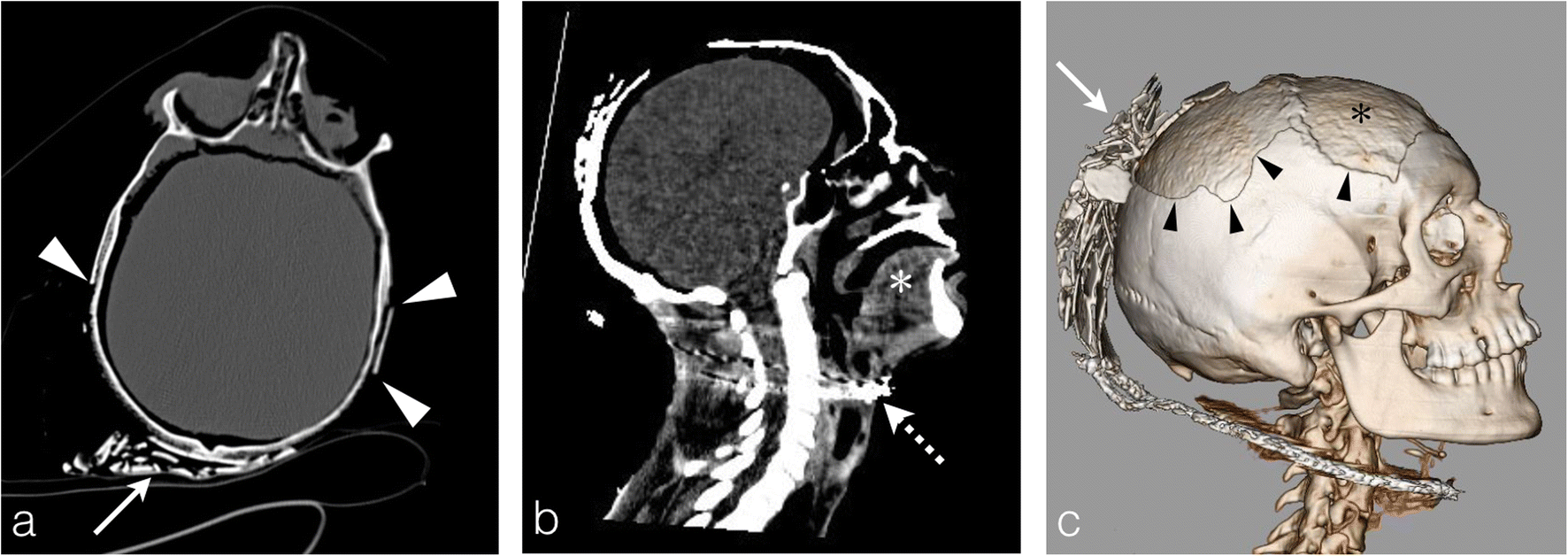 Fig. 12