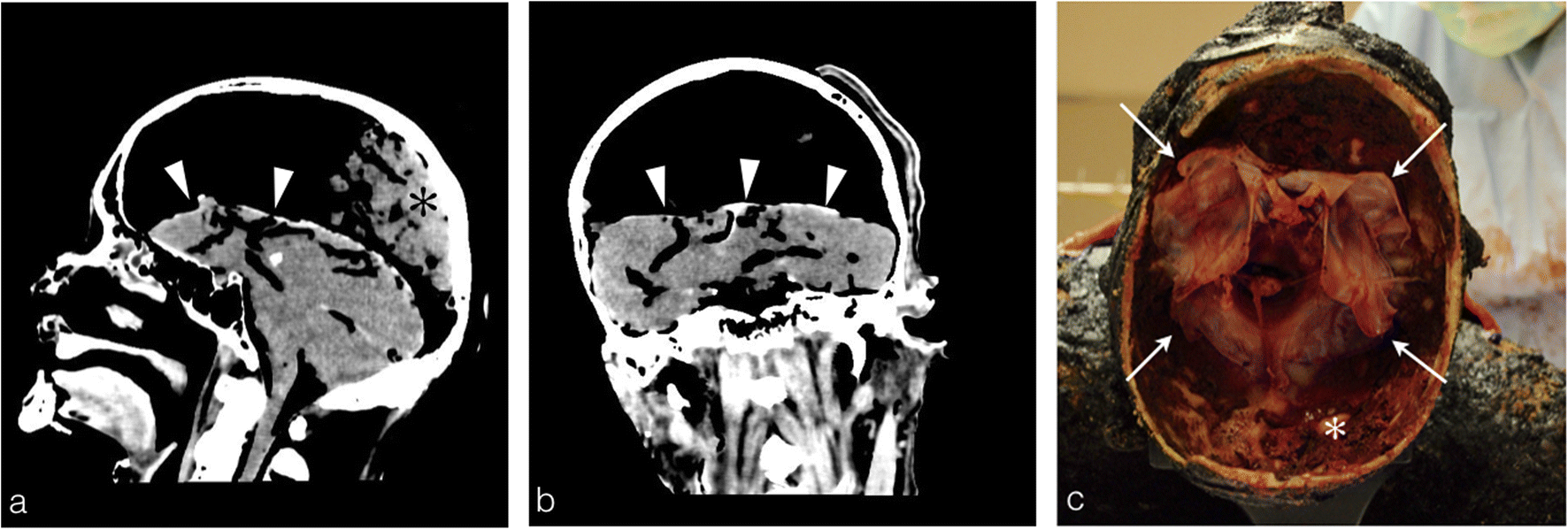 Fig. 14