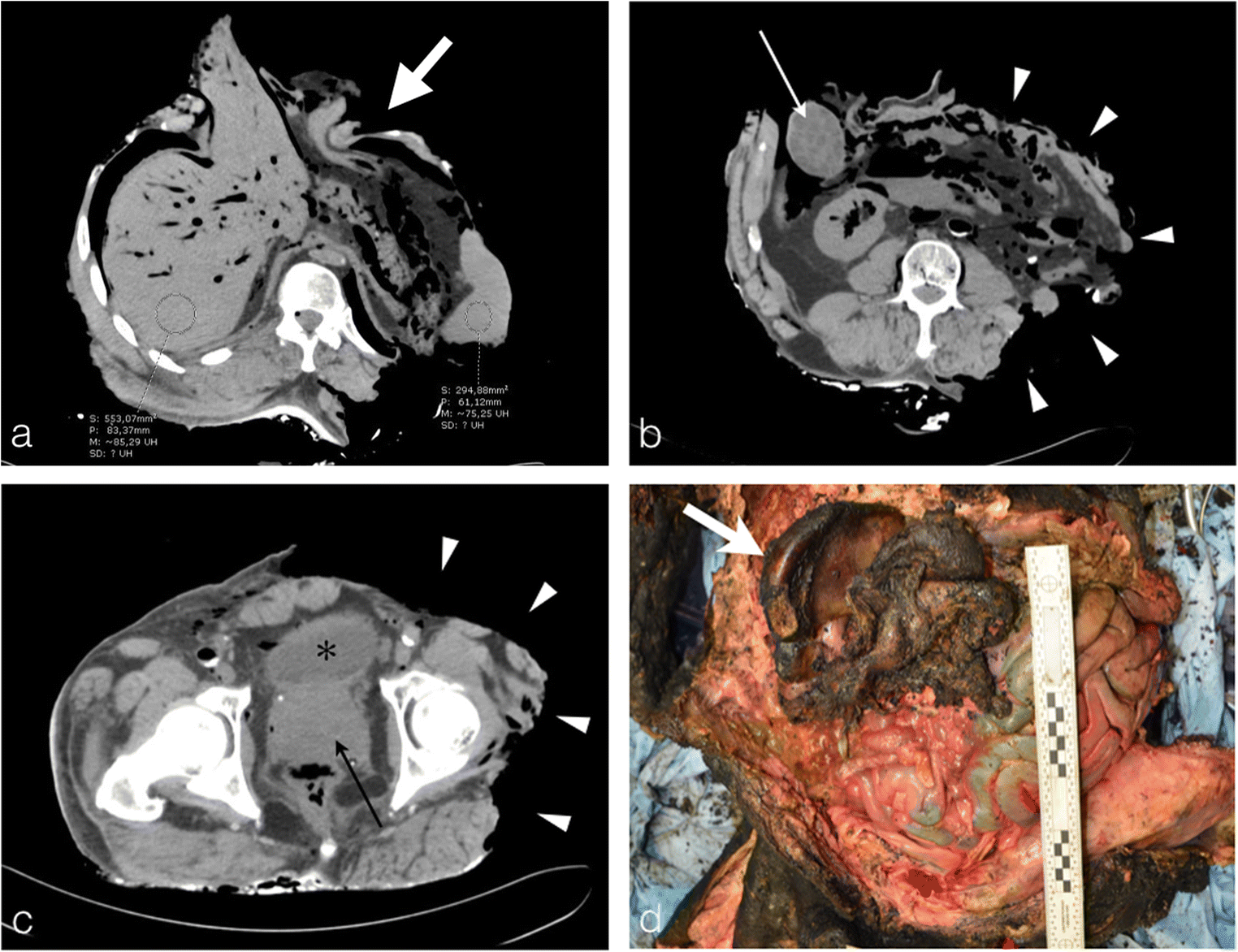 Fig. 18