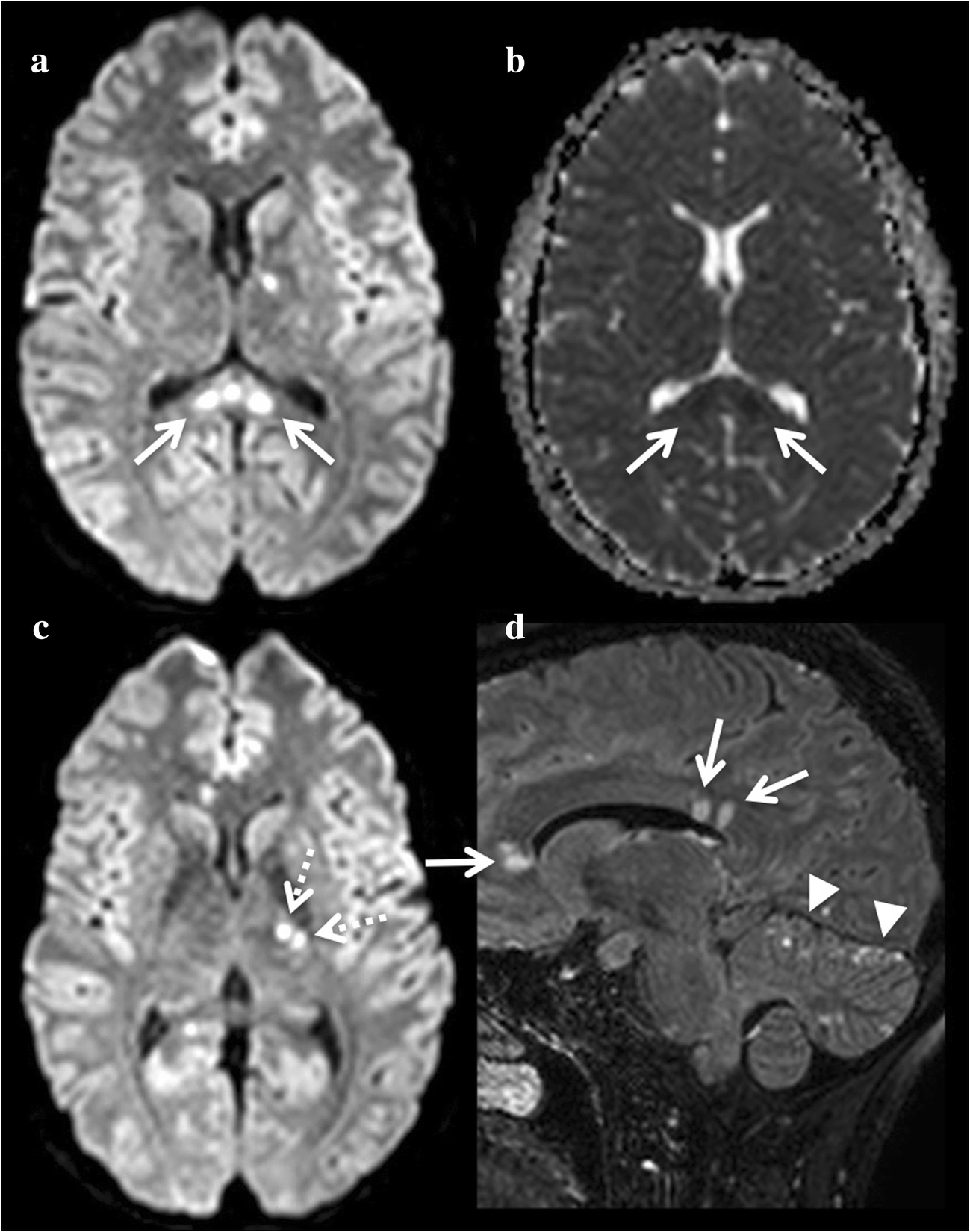 Fig. 10