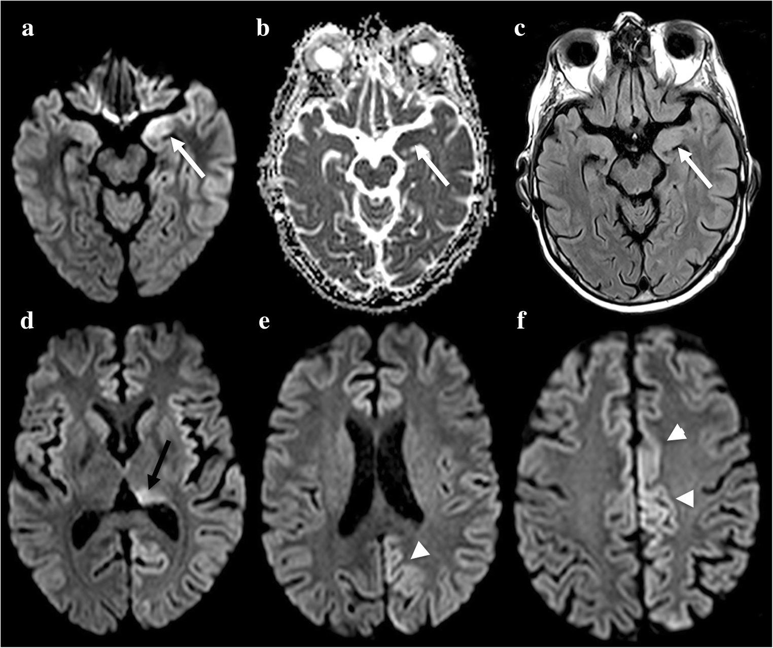 Fig. 4