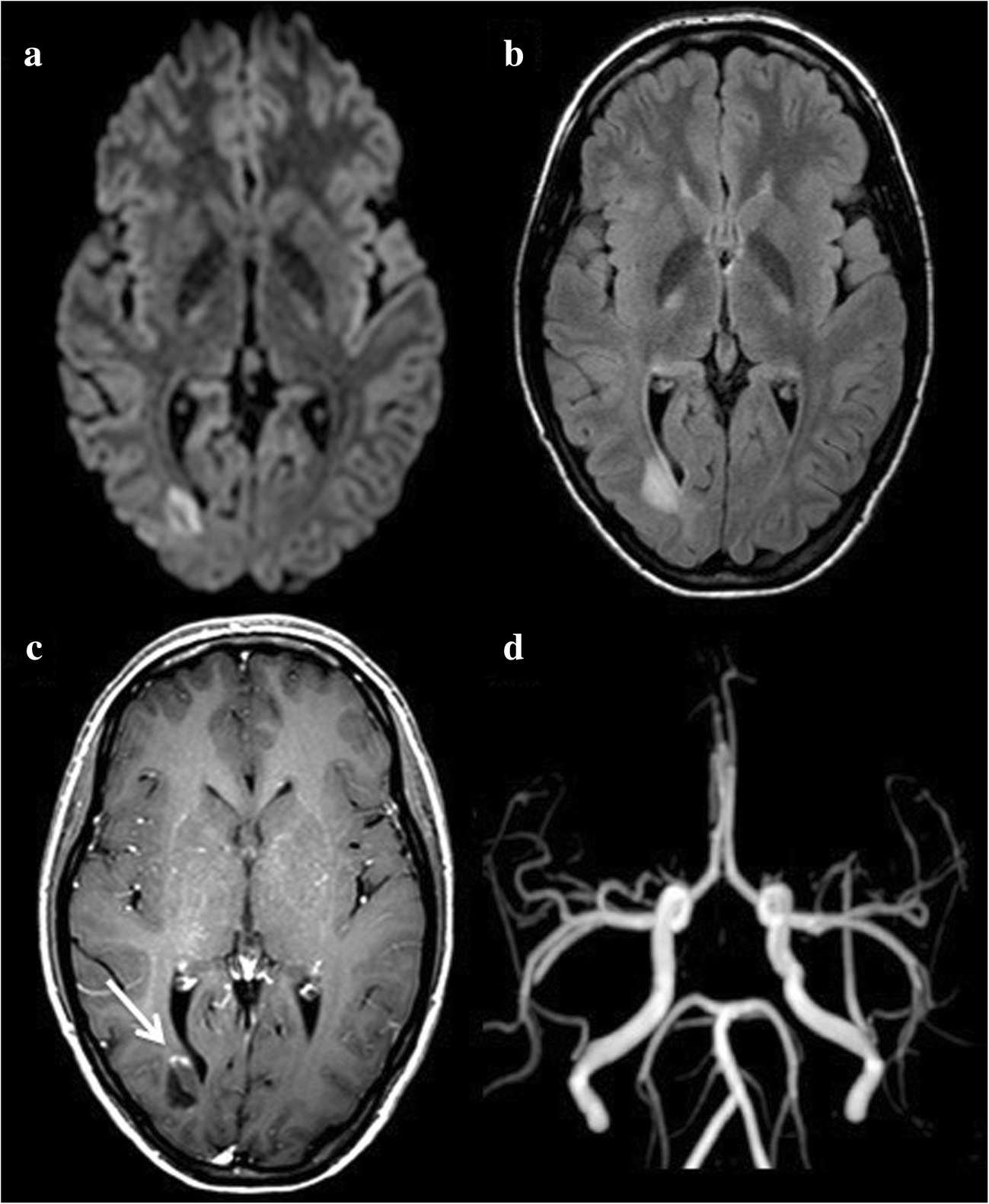 Fig. 9