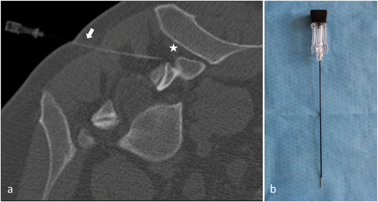 Fig. 9