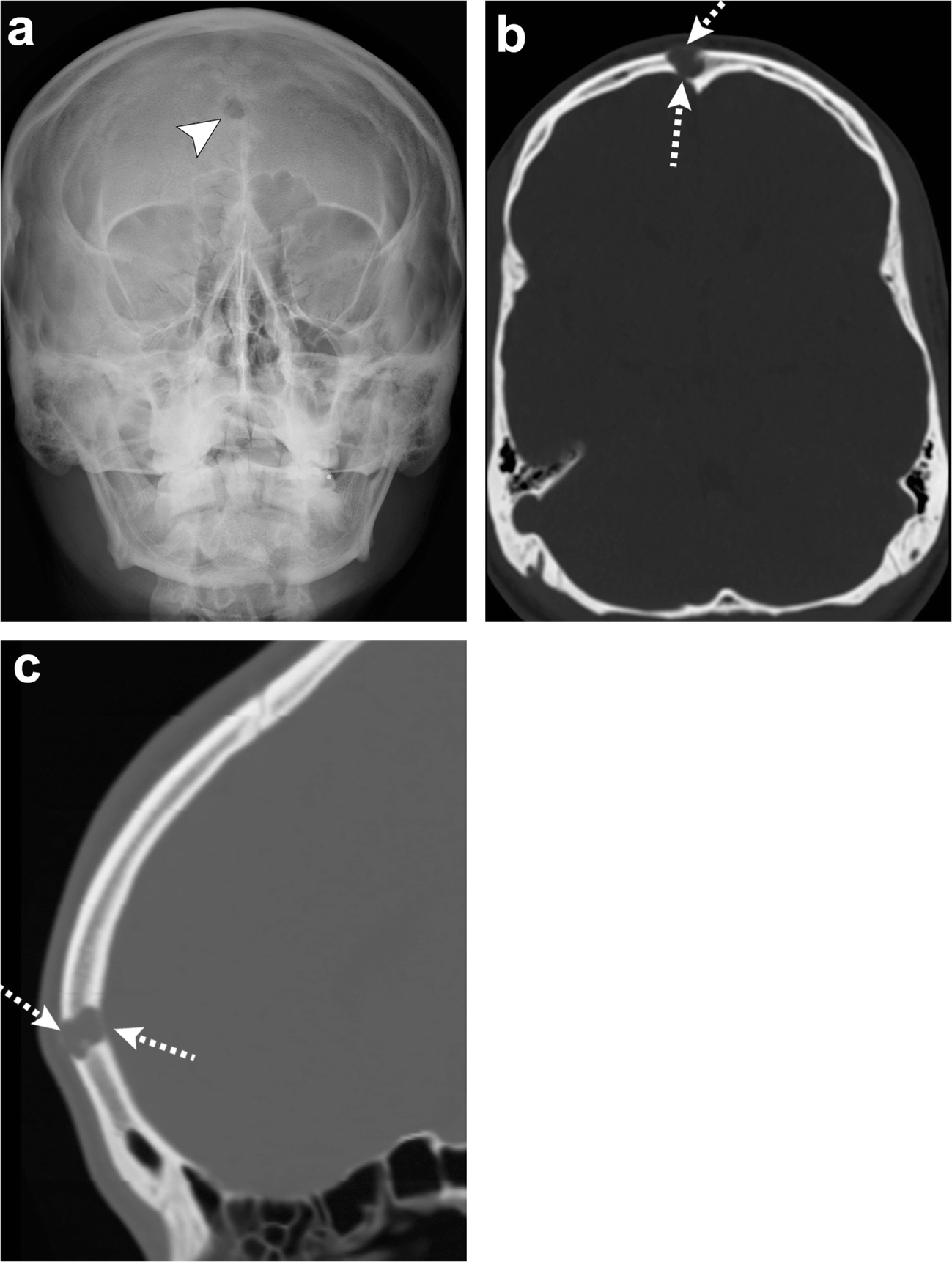 Fig. 12