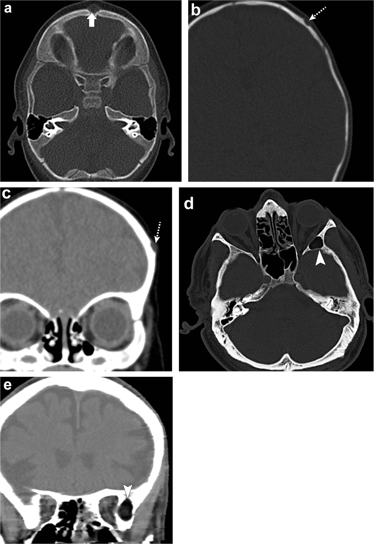 Fig. 14