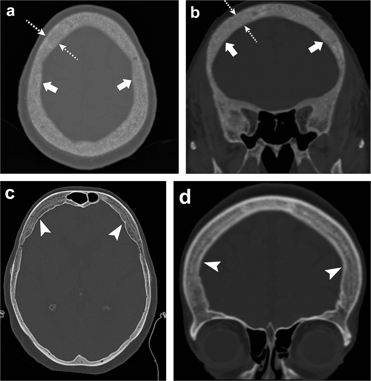 Fig. 22