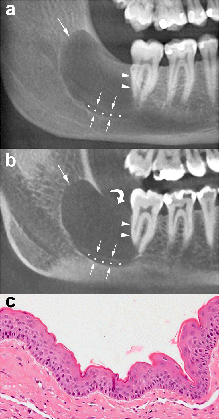 Fig. 10