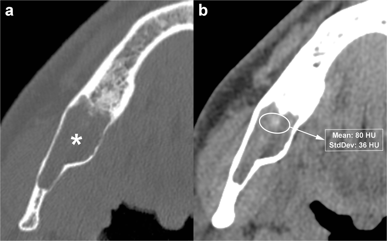 Fig. 12