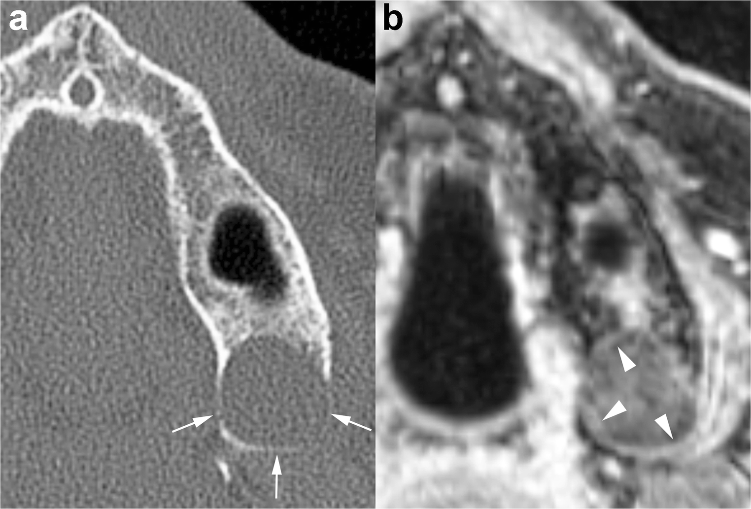 Fig. 14