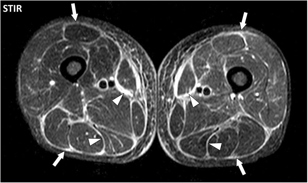 Fig. 10