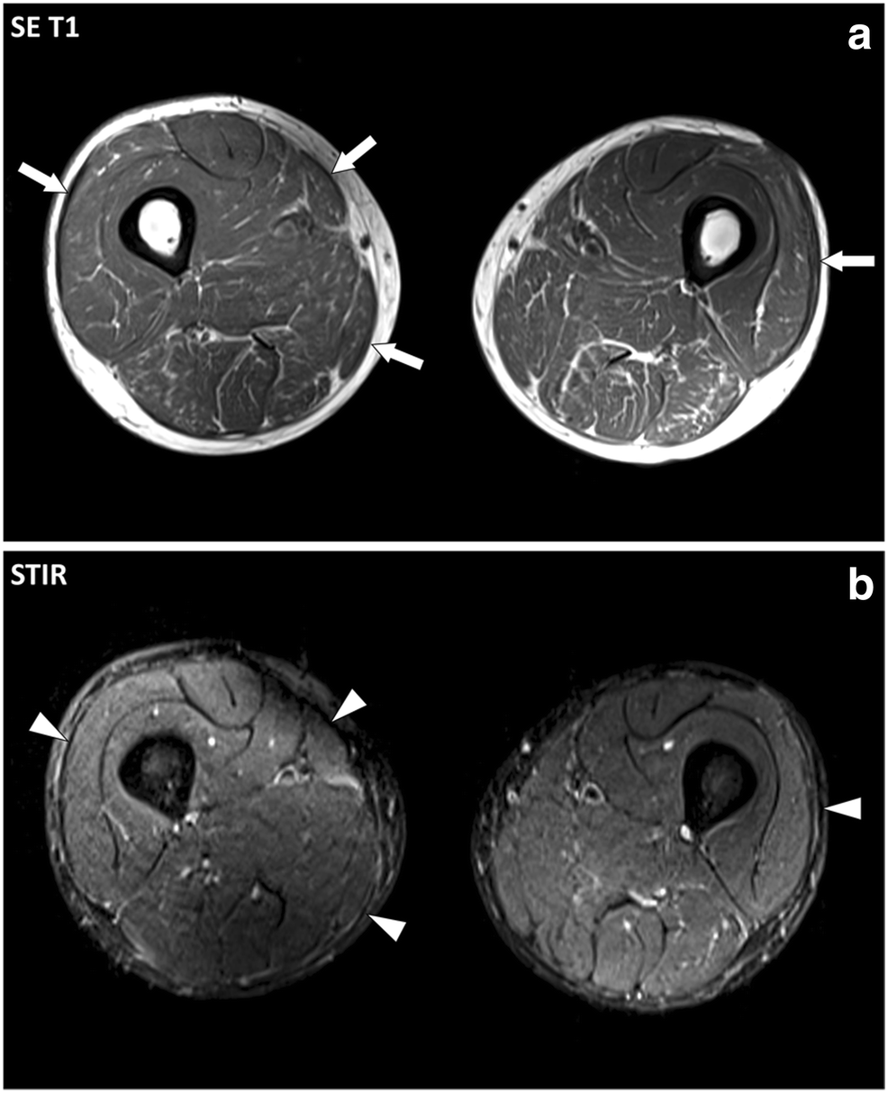 Fig. 11