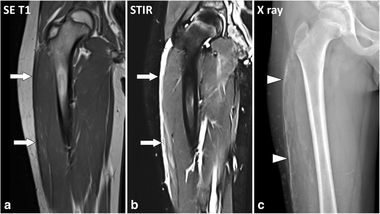 Fig. 12