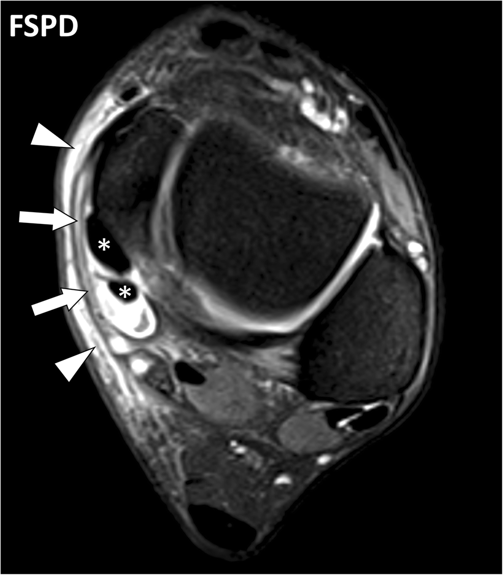 Fig. 13