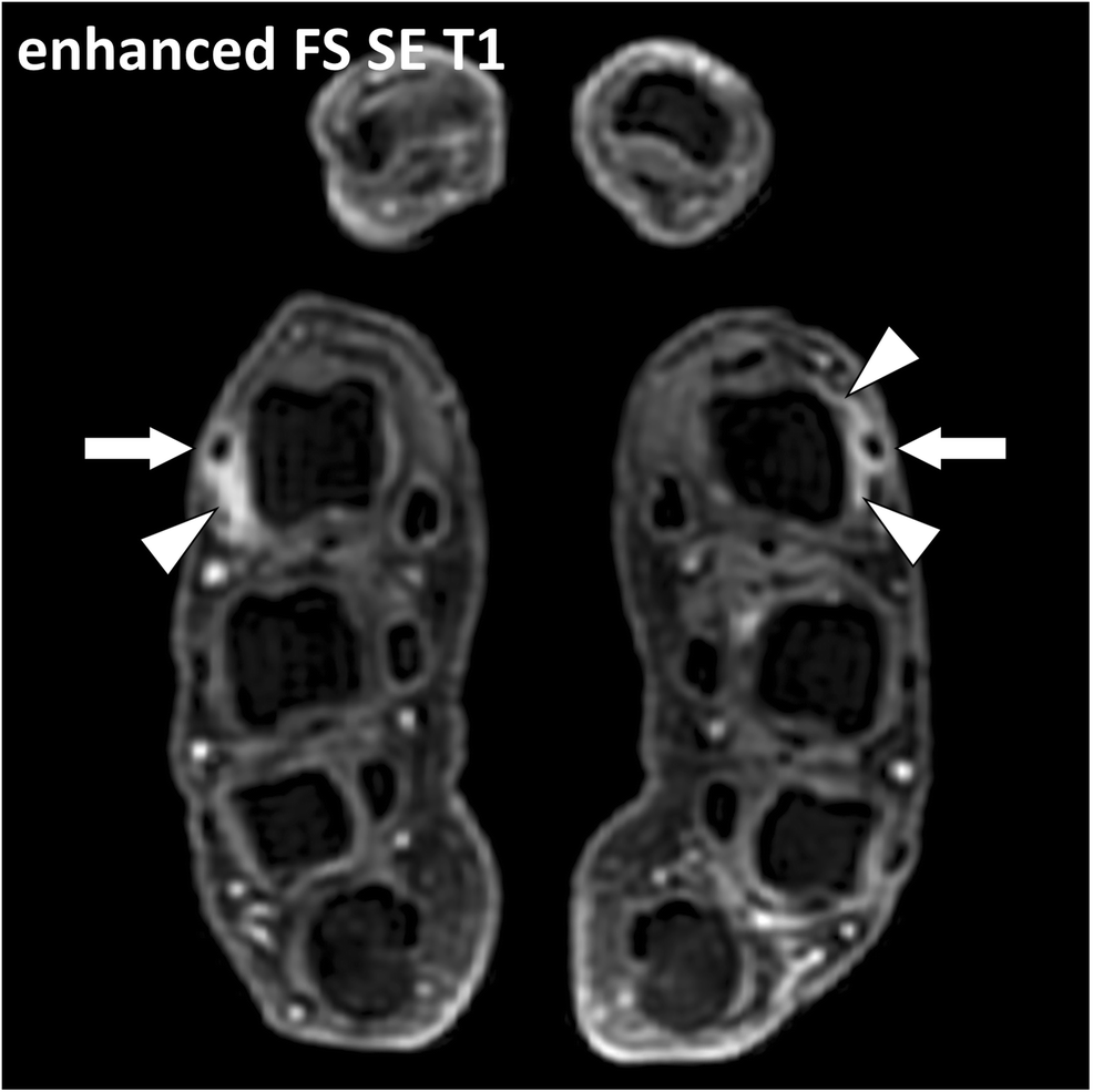 Fig. 14