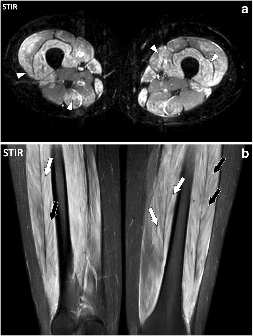 Fig. 15