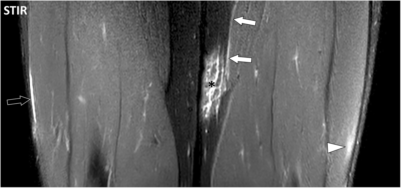 Fig. 19