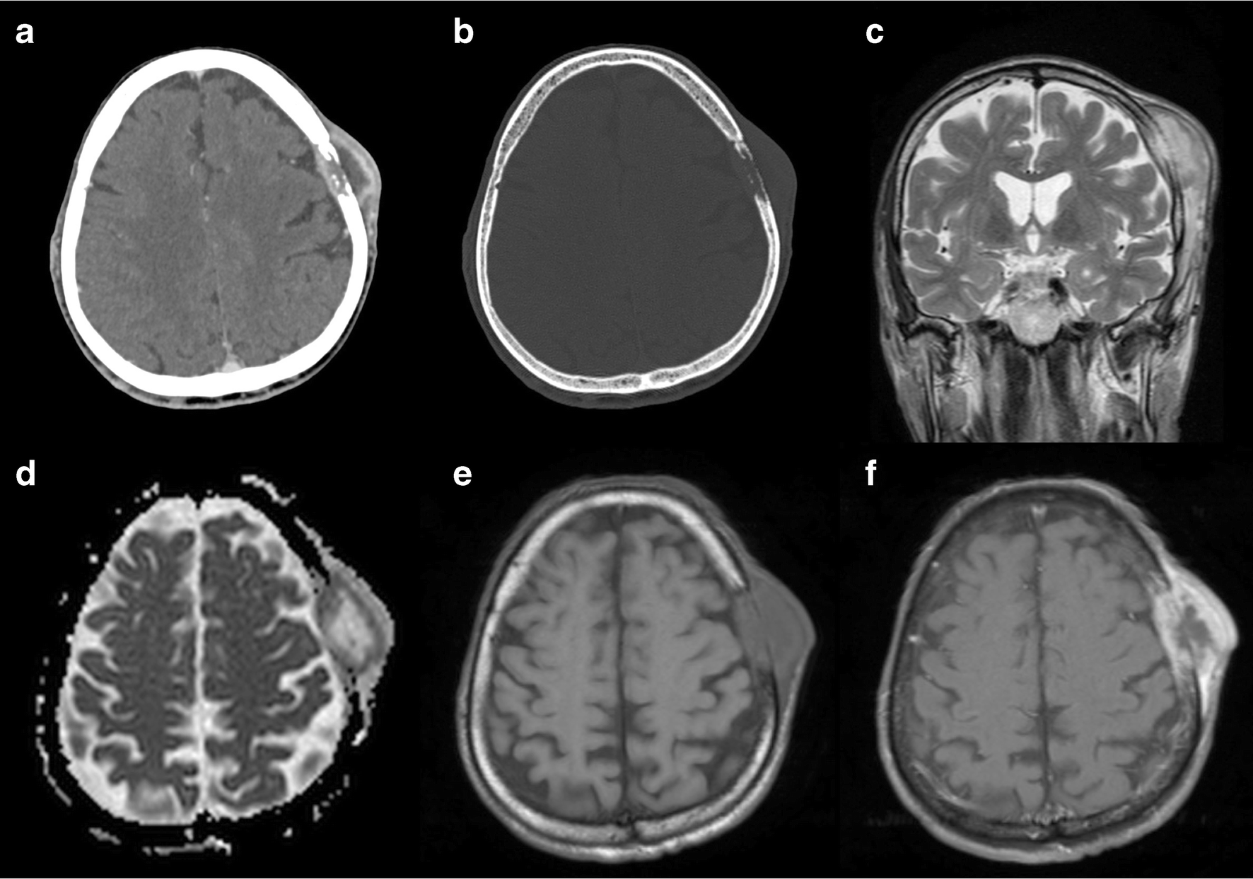 Fig. 14