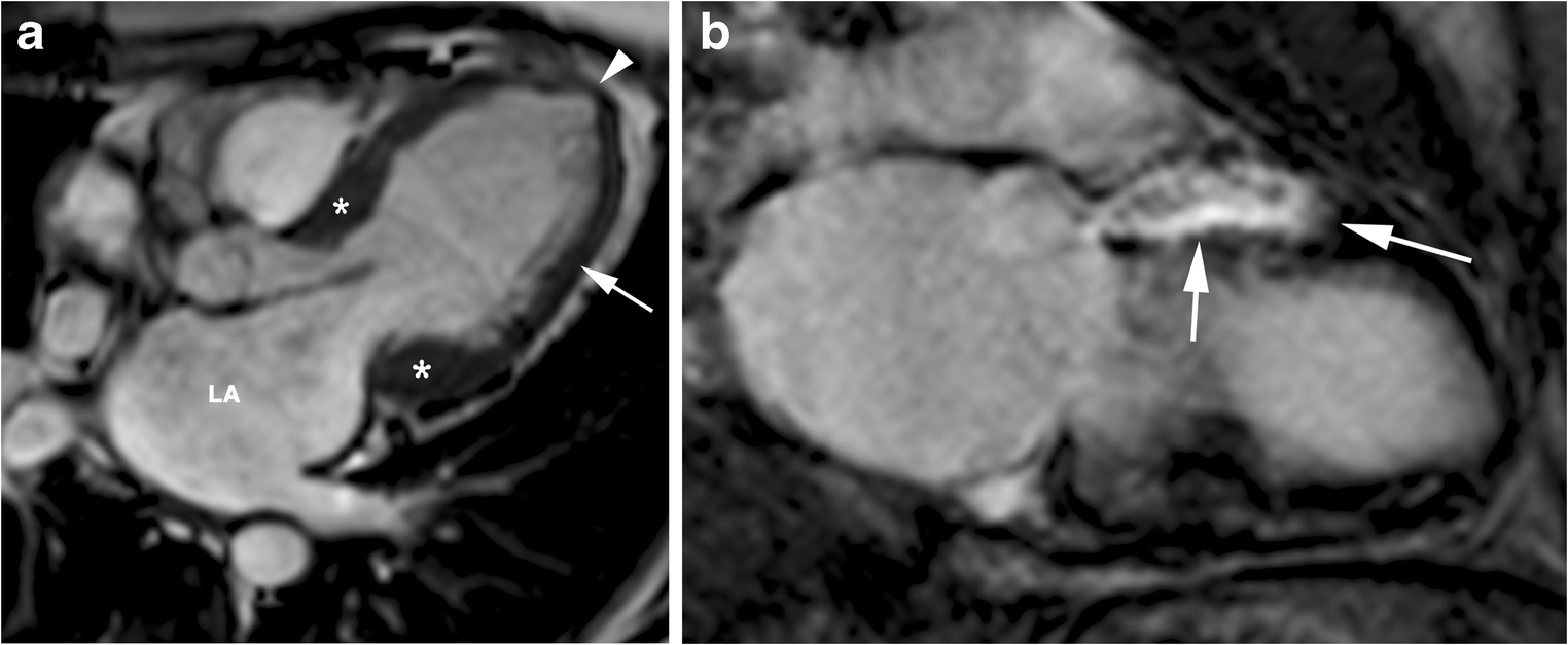 Fig. 11