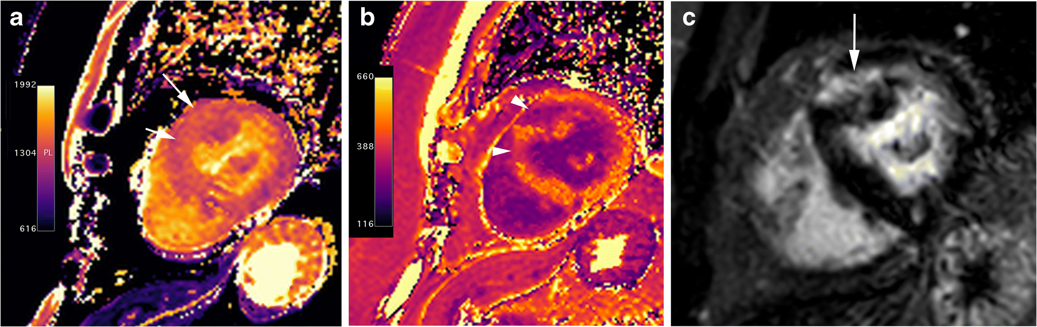 Fig. 9